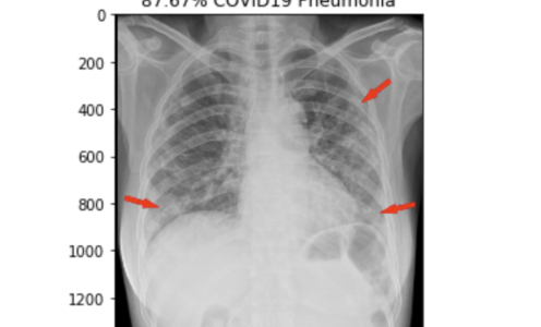 Image Classification of COVID-19 X-rays 