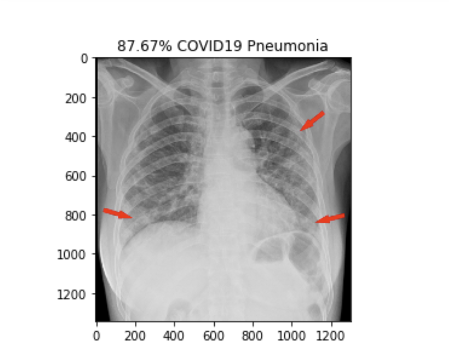 Image Classification of COVID-19 X-rays 